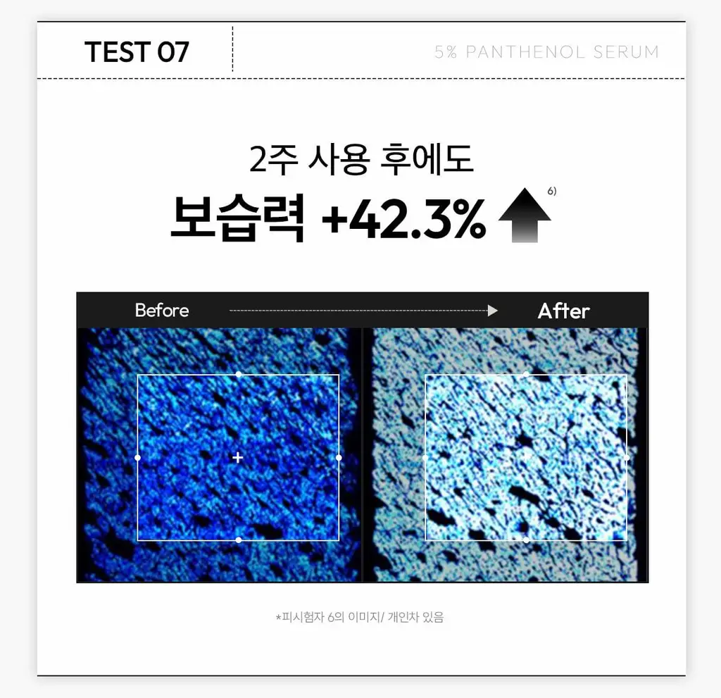 [6.9배 속보습 진정세럼] 레이어랩 니오좀 판테놀 5% 세럼 30ml 기획 (+1.5ml*5ea) 상세페이지 28